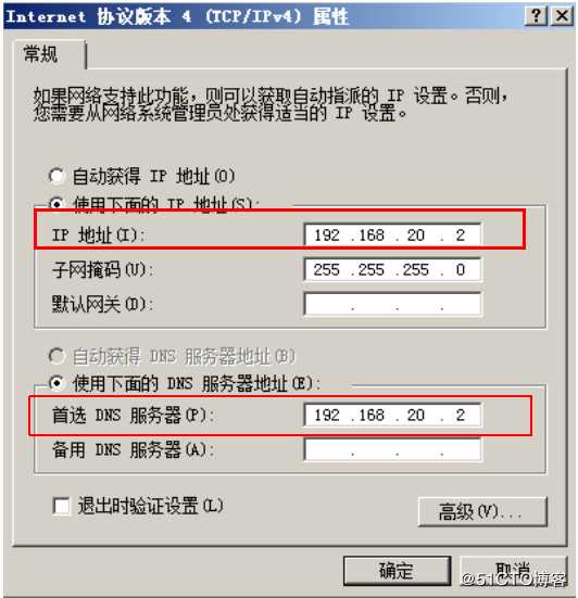 windows  server  2008 AD与DNS服务器配置时注意的问题